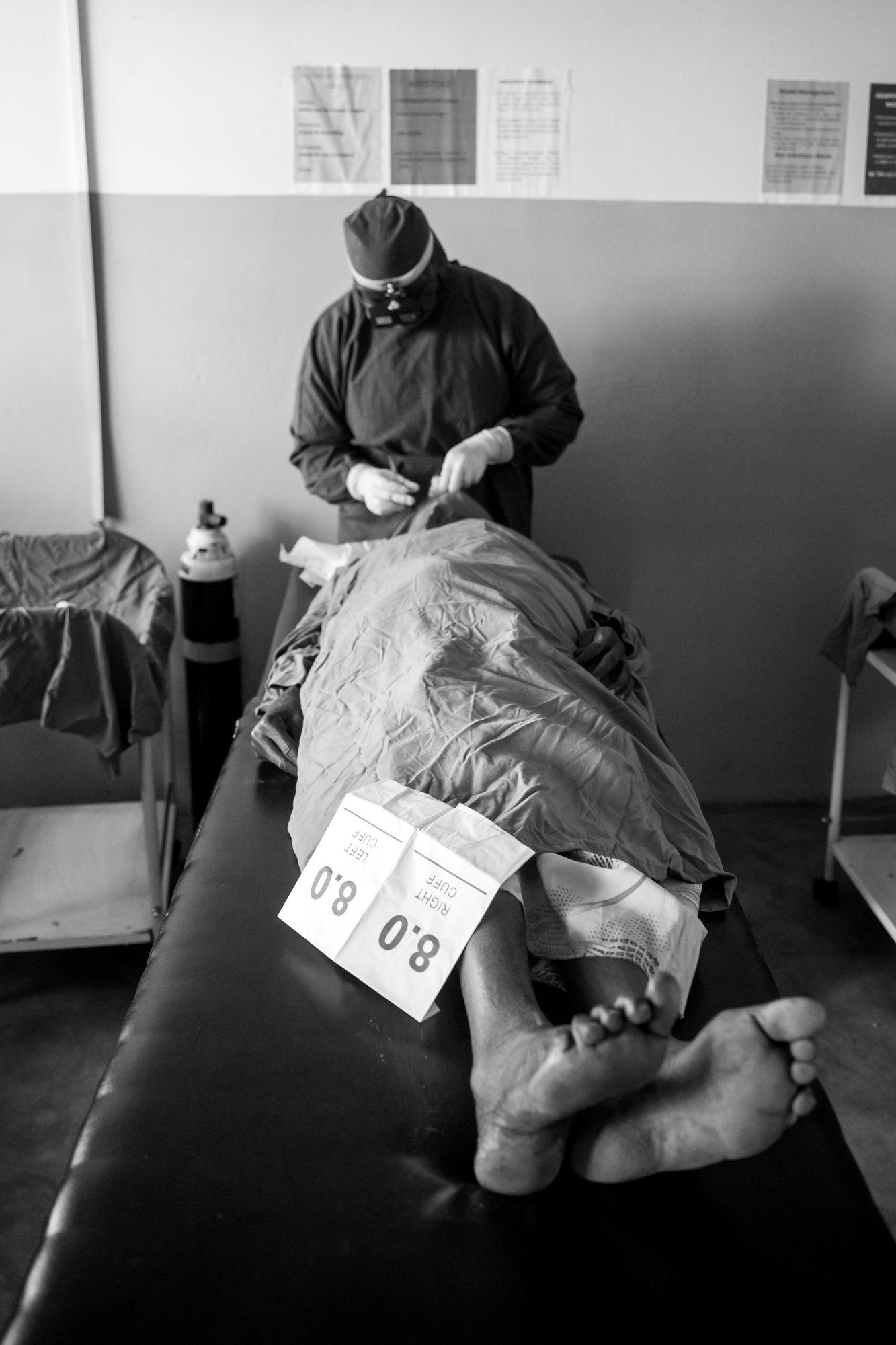 Trichiasis Surgery — photograph 7