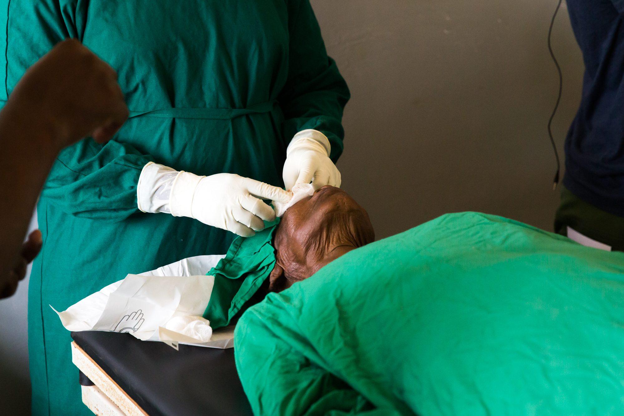 Trichiasis Surgery — photograph 11